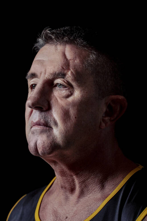 For the Love of the Game Carl Hamans, former rugby player diagnosed with early onset dementia and probable chronic encephalopathy (CTE) aged 52 years old.